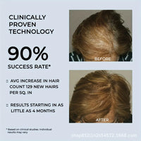 Red Light Therapy For Hair Growth SONOCOUTURE